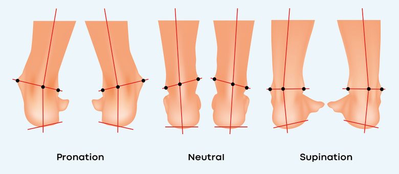 Fußstellung Pronation, Neutral, Supination